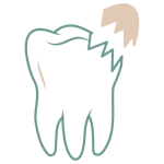 broken-tooth_7336122 1